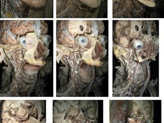  4D Interactive Anatomy