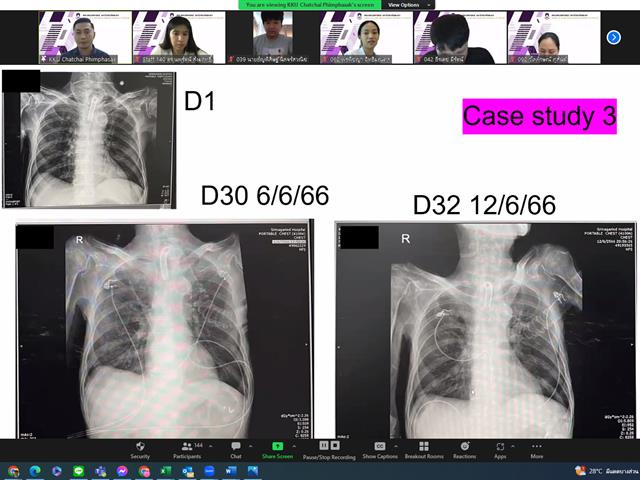 คณะสหเวชศาสตร์ จัดโครงการประชุมวิชาการ กายภาพบำบัด ม.พะเยา เรื่อง แนวคิดการจัดการทางกายภาพบำบัดระบบหายใจในผู้ป่วยกลุ่มโรคปอดอุดกั้น