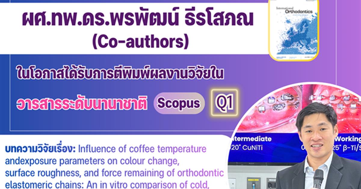 คณะทันตแพทยศาสตร์ มหาวิทยาลัยพะเยา ขอแสดงความยินดีกับ ผศ.ทพ.ดร.พรพัฒน์ ธีรโสภณ (Co-authors) ในโอกาสได้รับการตีพิมพ์ผลงานวิจัยในวารสารระดับนานาชาติ ฐานข้อมูล Scopus Q1